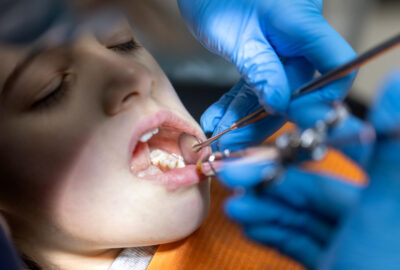 Découvrez les différences entre dentiste et orthodontiste et choisissez le bon spécialiste pour un sourire sain au Cabinet Dentaire Chaville‑Viroflay.