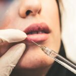 Chirurgie orale : interventions, préparation et suivi post-opératoire