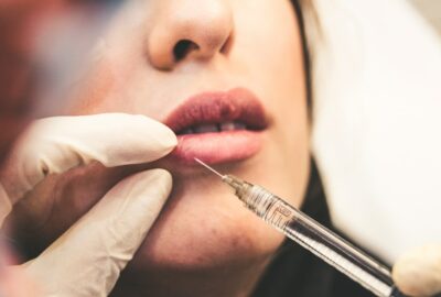 Chirurgie orale : interventions, préparation et suivi post-opératoire